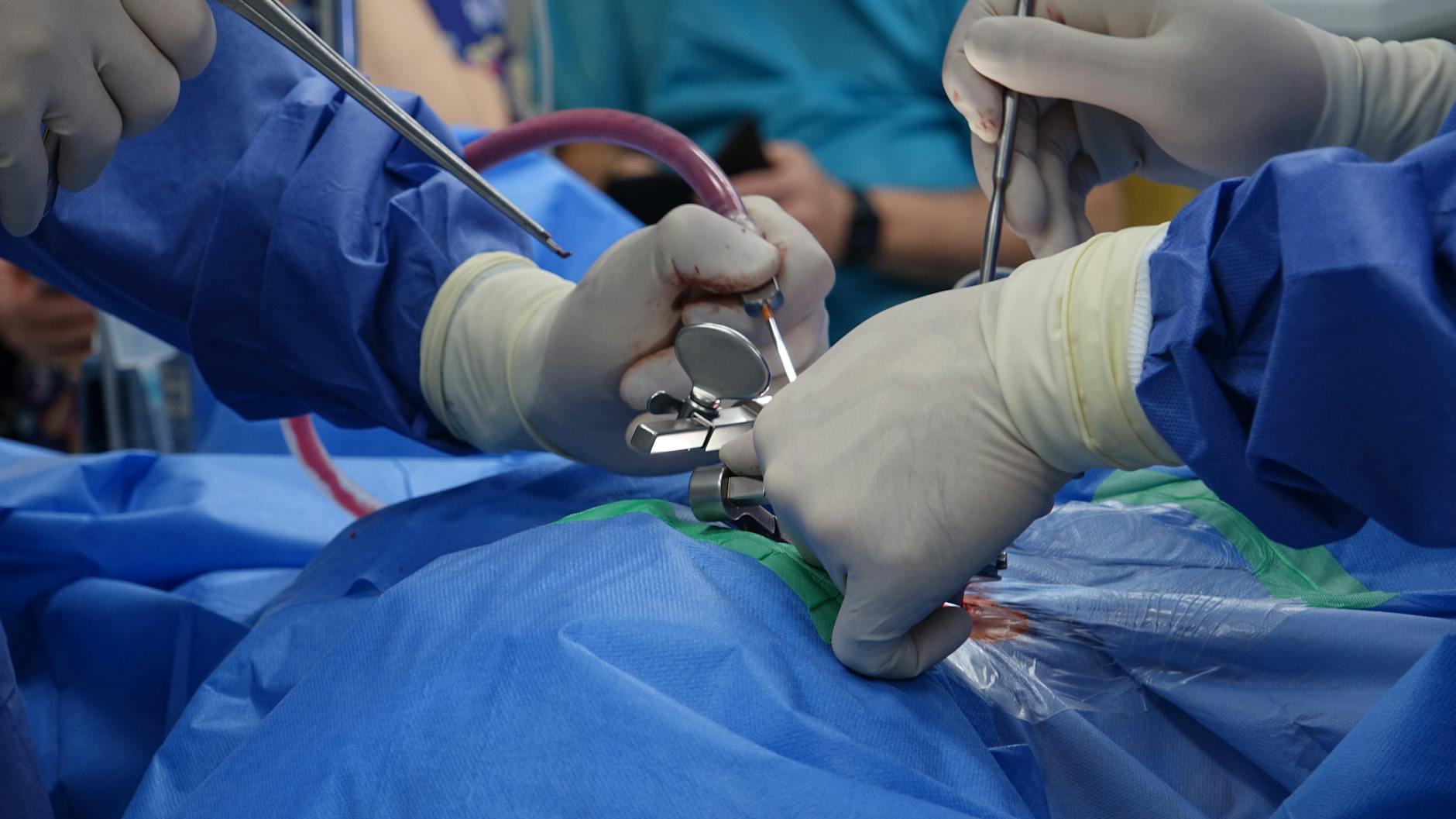 How Much Is A Spinal Cord Injury Settlement - Featured image