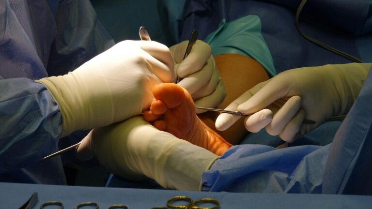 How Long After Surgery Can You File a Lawsuit - Featured image