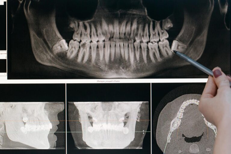 Average Settlement for Broken Jaw From Accident - Featured image