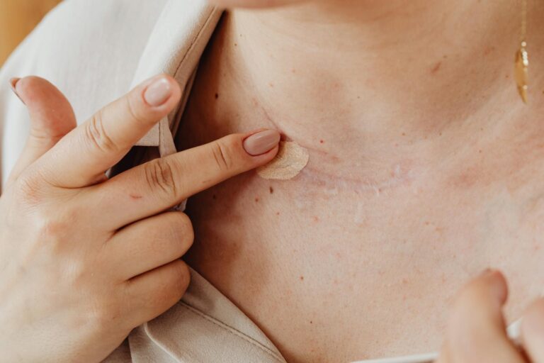 Average Settlement for Scarring and Disfigurement - Featured image