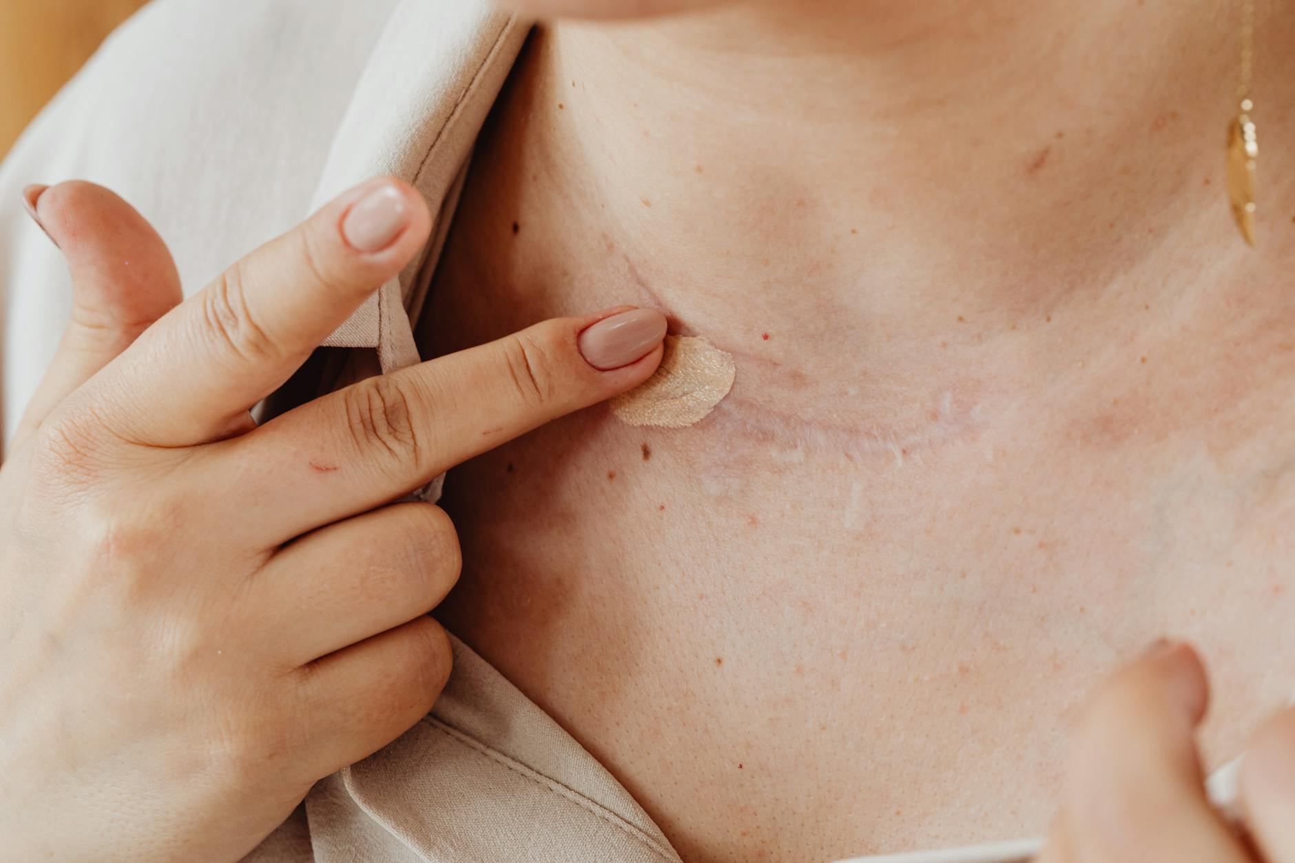 Average Settlement for Scarring and Disfigurement - Featured image