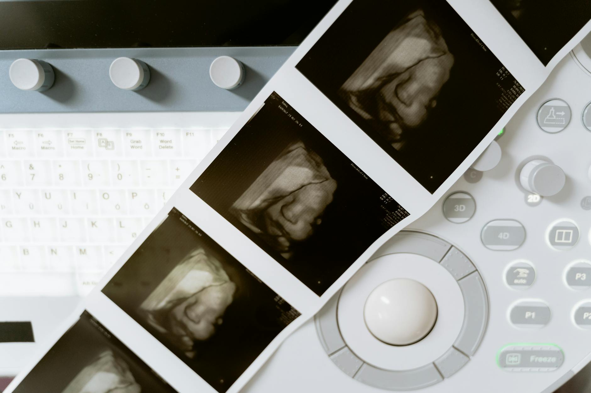 How Much Can You Sue for Fetal Distress Mismanagement - Featured image