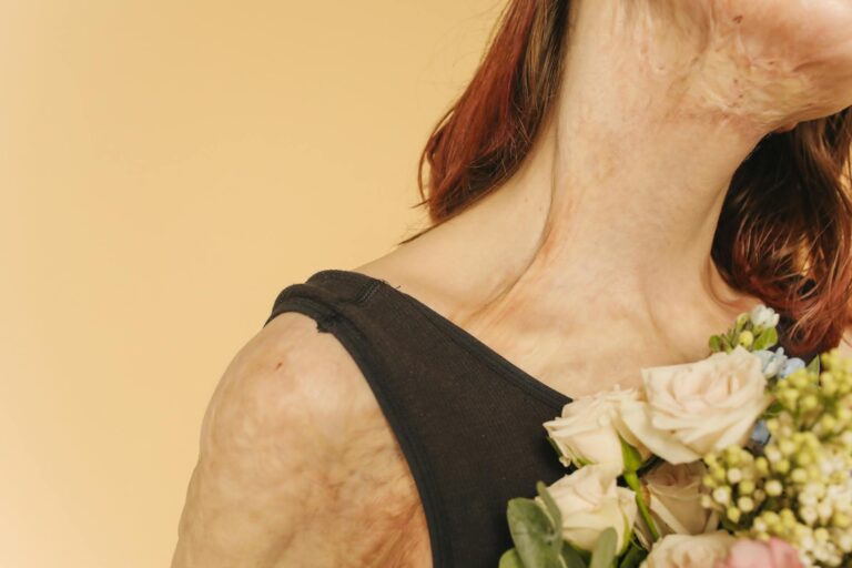 How Much Can You Sue for Mesothelioma - Featured image