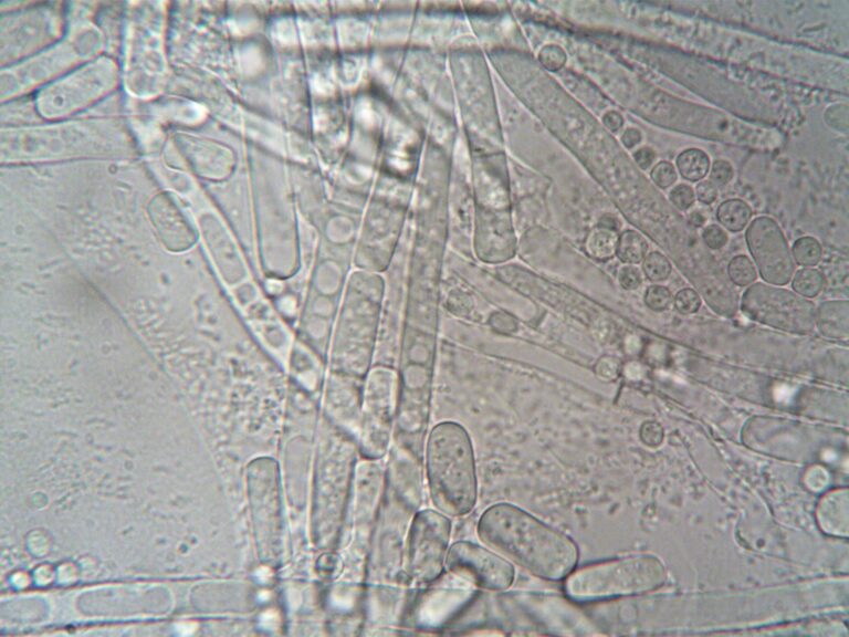 How Much Can You Sue for Mold Exposure - Featured image