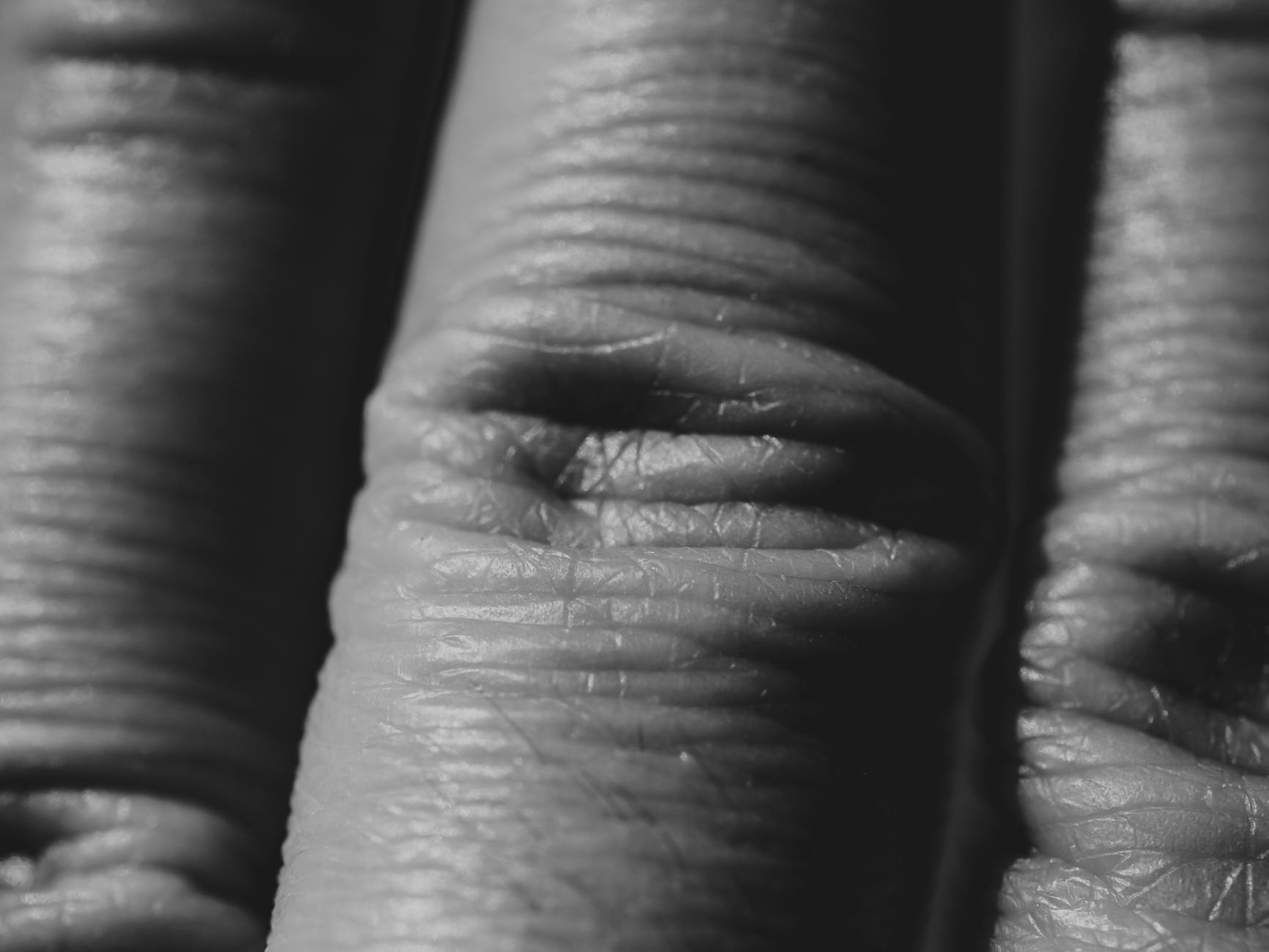 How Much Do CRPS Settlements Typically Average?