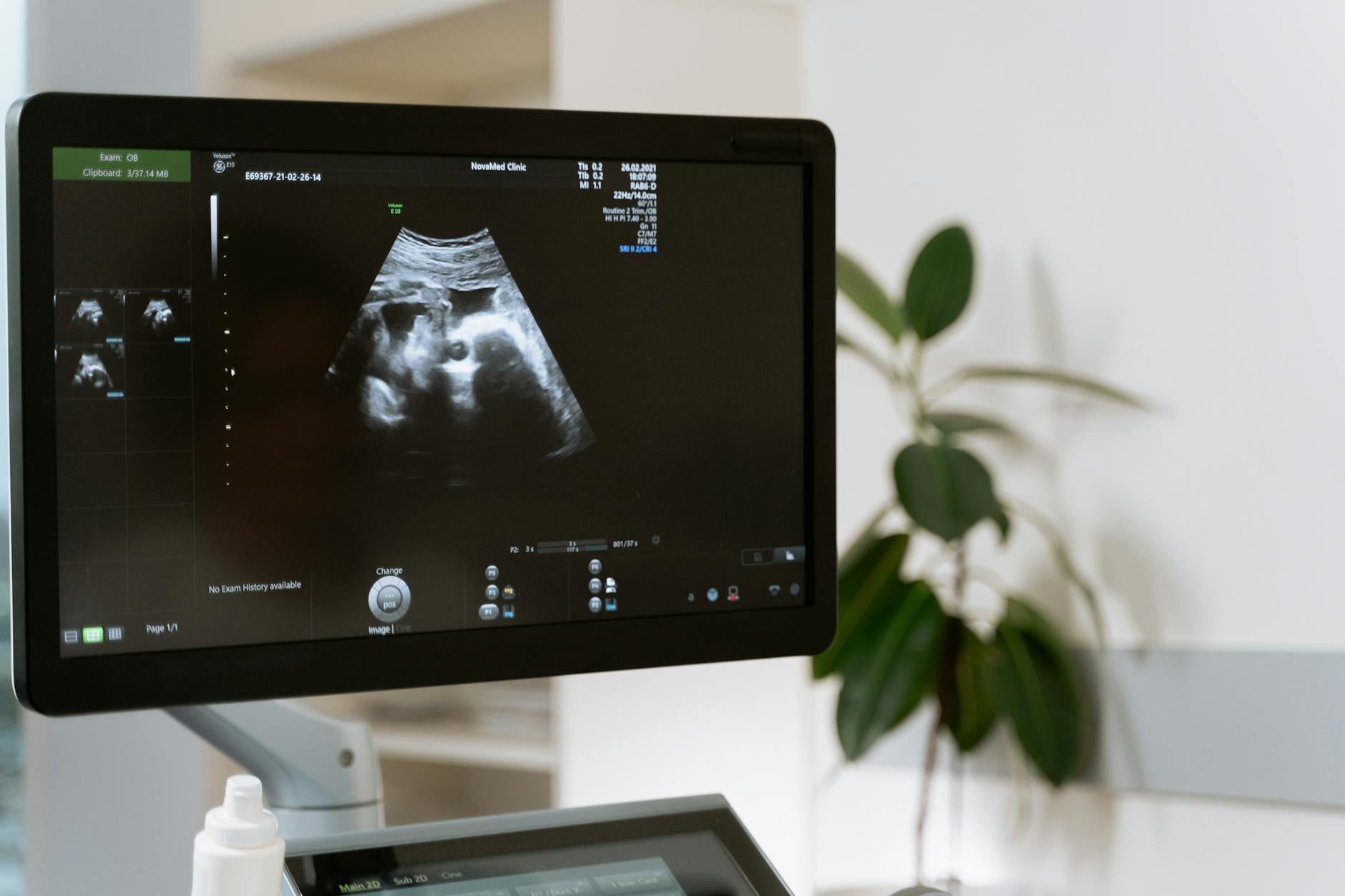 How to Prove Obstetric Malpractice - Featured image