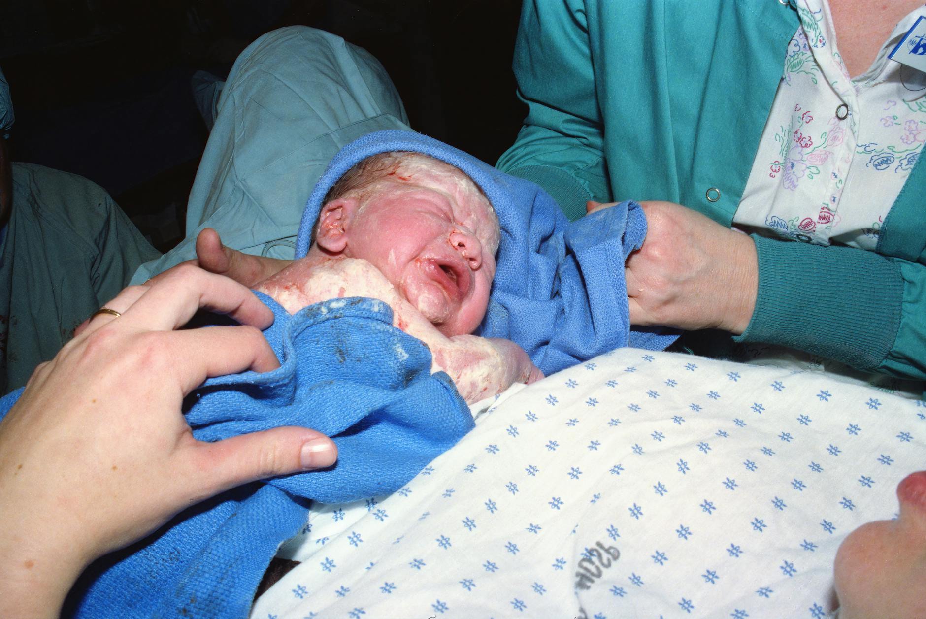 Medical Malpractice Context and Birth Injury Settlements