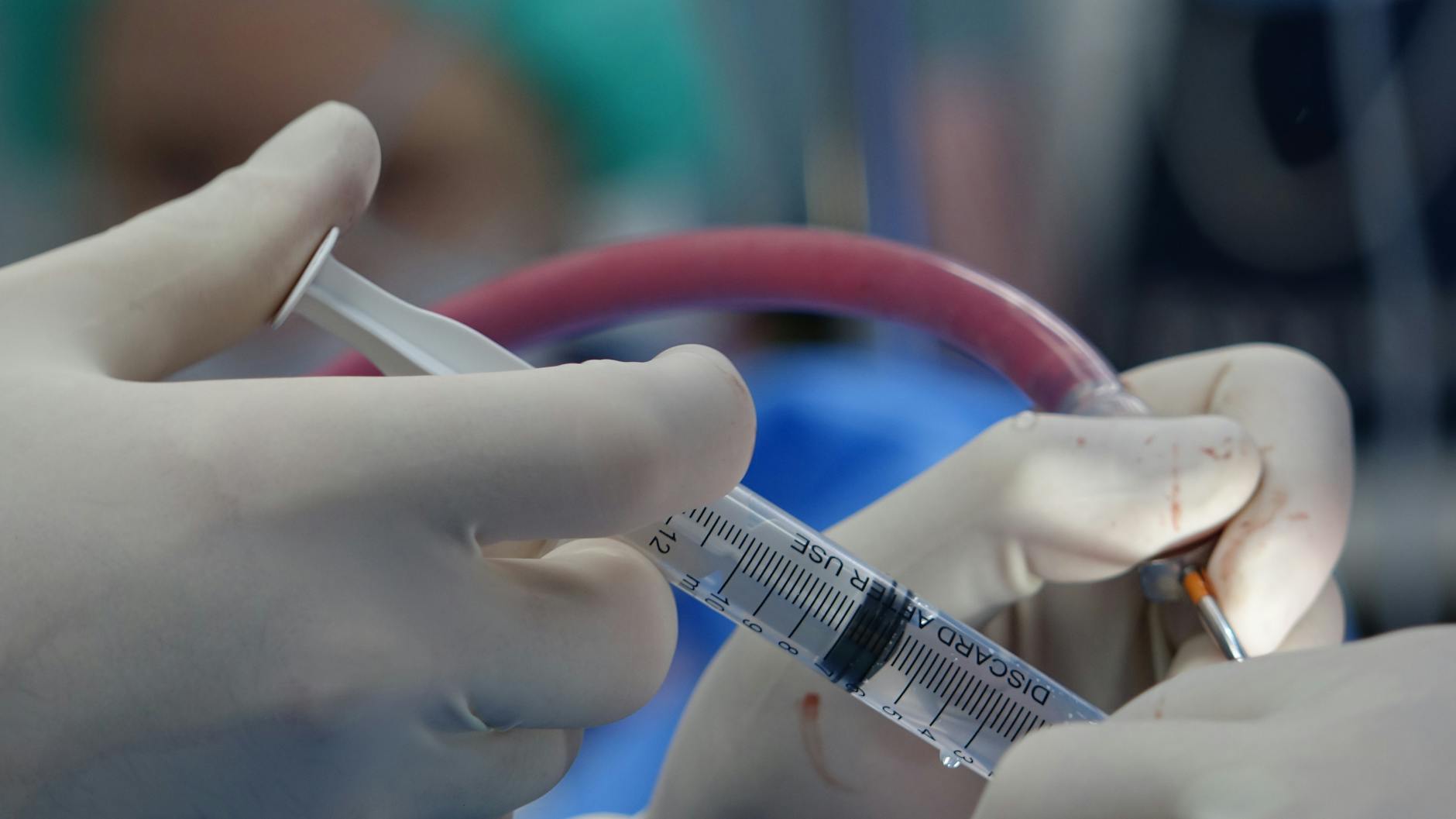 Medical Malpractice Settlements for Nerve Injuries