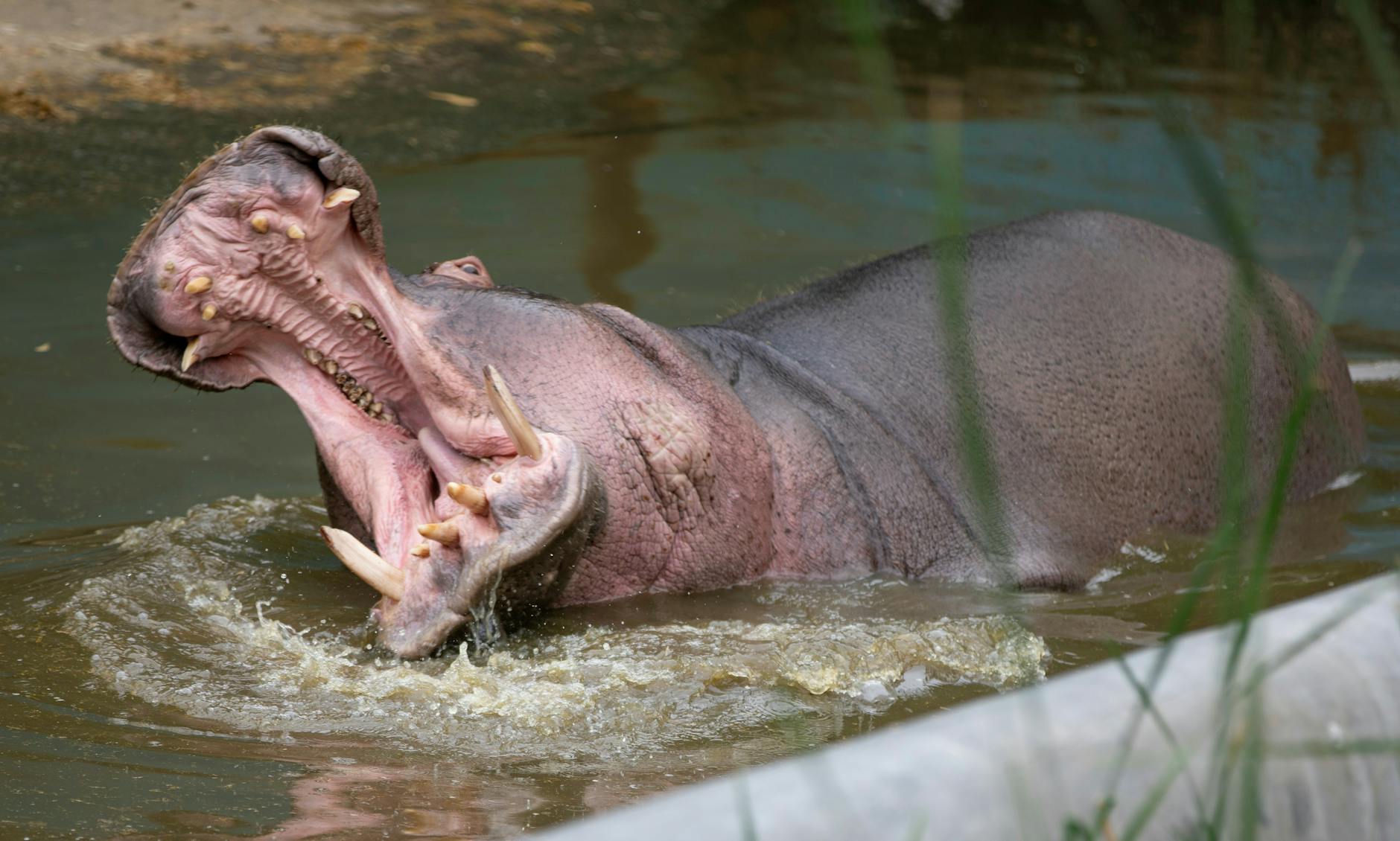 The $775,000 Broken Jaw Settlement: A Real-World Example