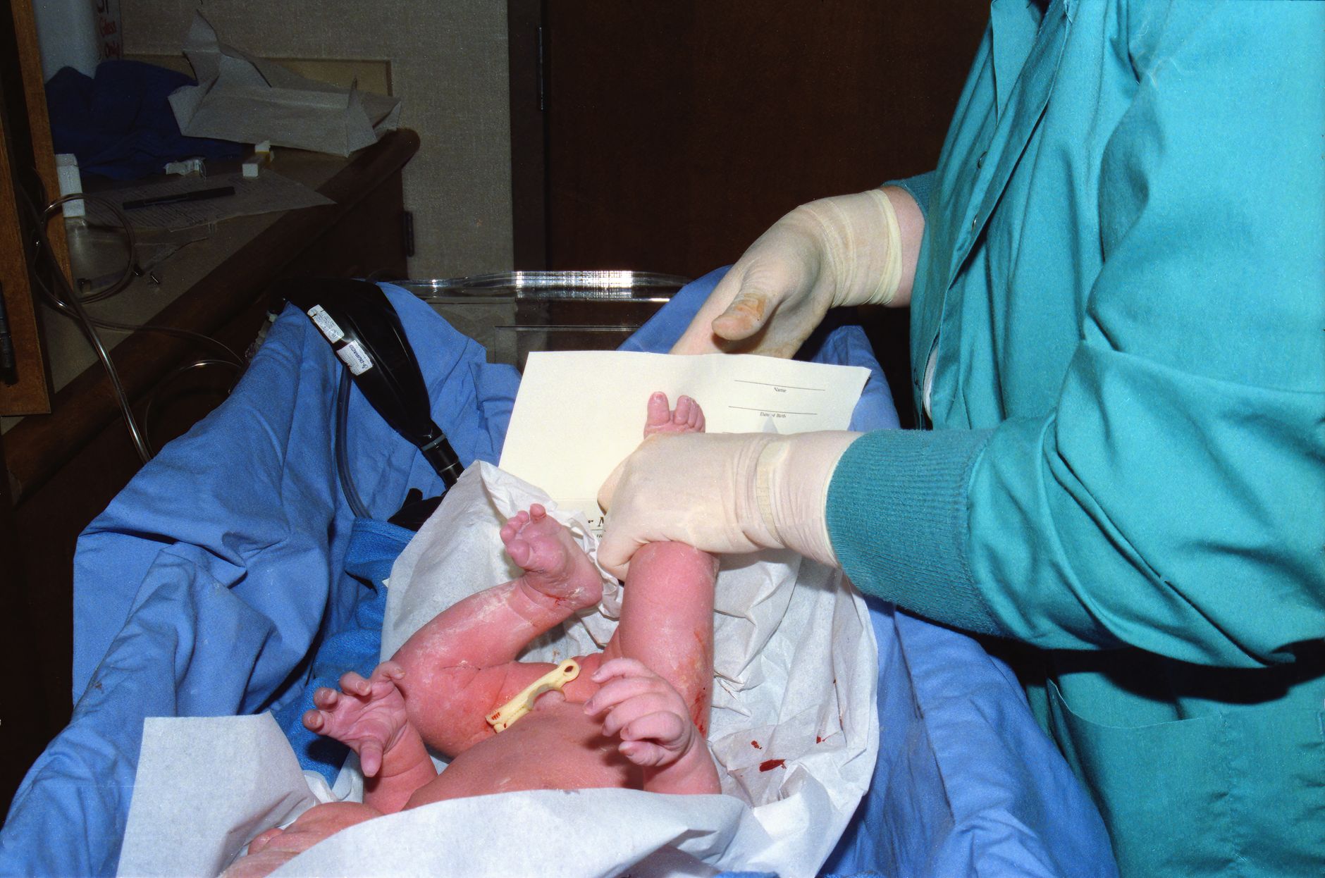 Types of Umbilical Cord Complications and Their Settlement Patterns