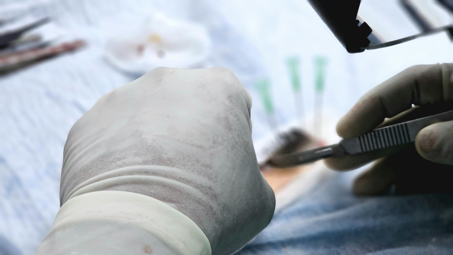 What Constitutes a Surgical Error Under Medical Malpractice Law?