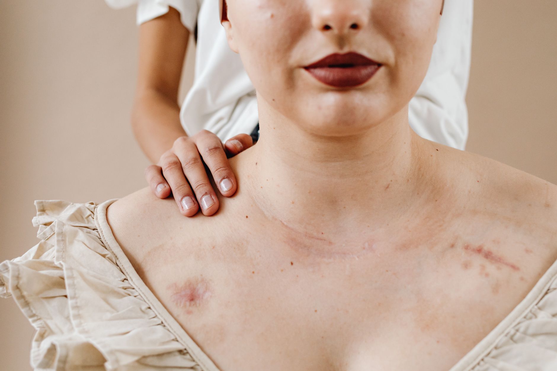 Scarring Personal Injury Claims October 2026 Update: What Changed, Why It Matters, and What to Watch Next - Featured image